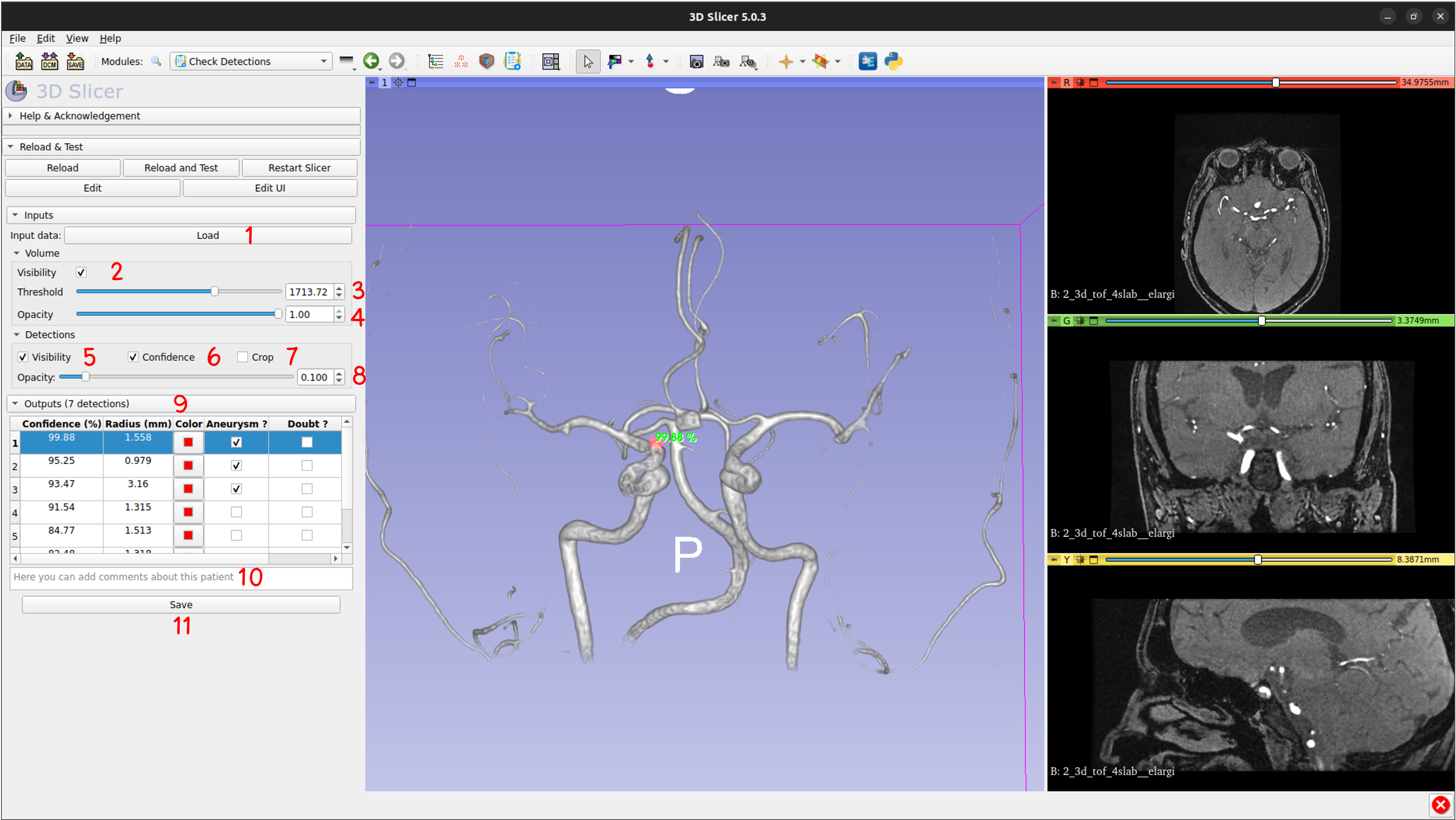 3D Slicer plugin for visualisation