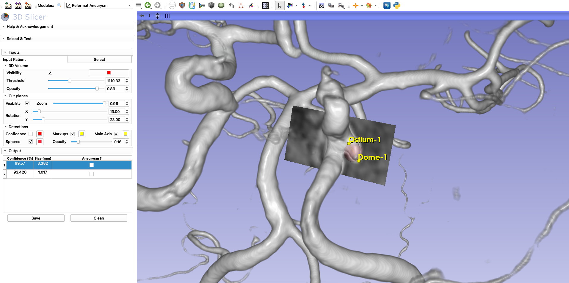 3D Slicer plugin for visualisation